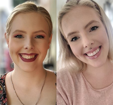 invisalign dentist