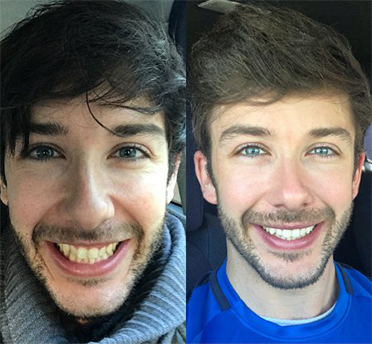 invisalign dentist