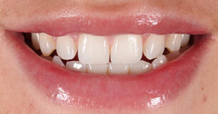Before - Ringway Dental