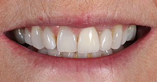 Before - Ringway Dental