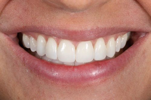 ringwaydental
