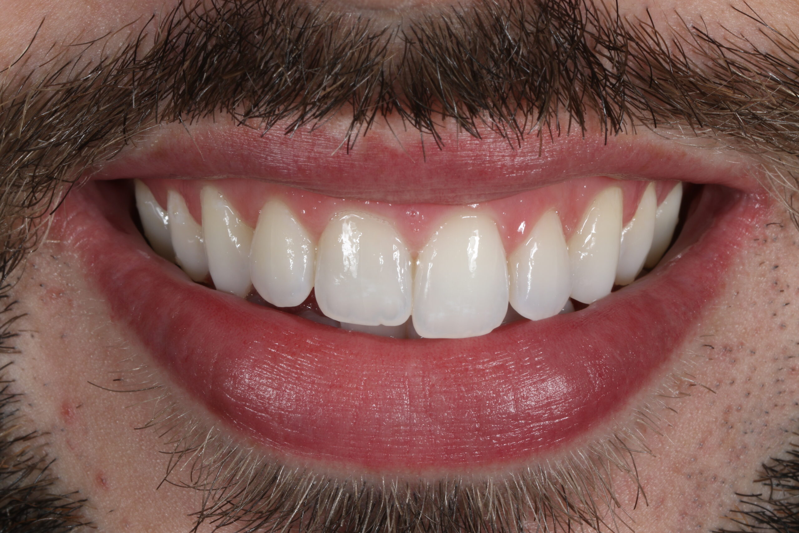 ringwaydental