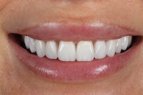 ringwaydental