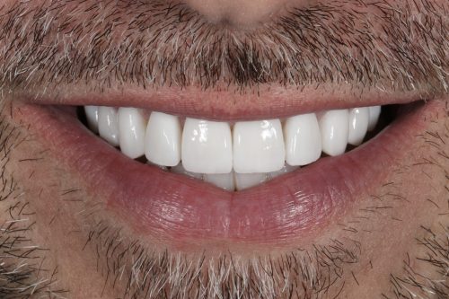 ringwaydental