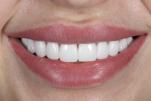 ringwaydental