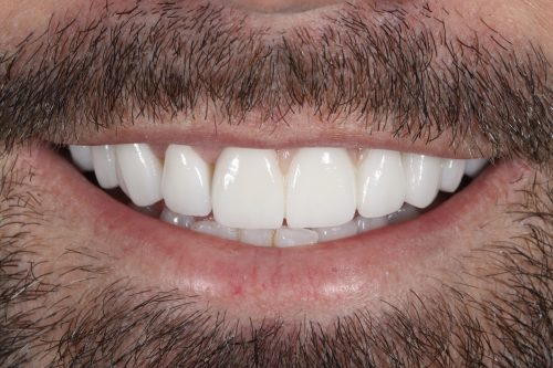 ringwaydental