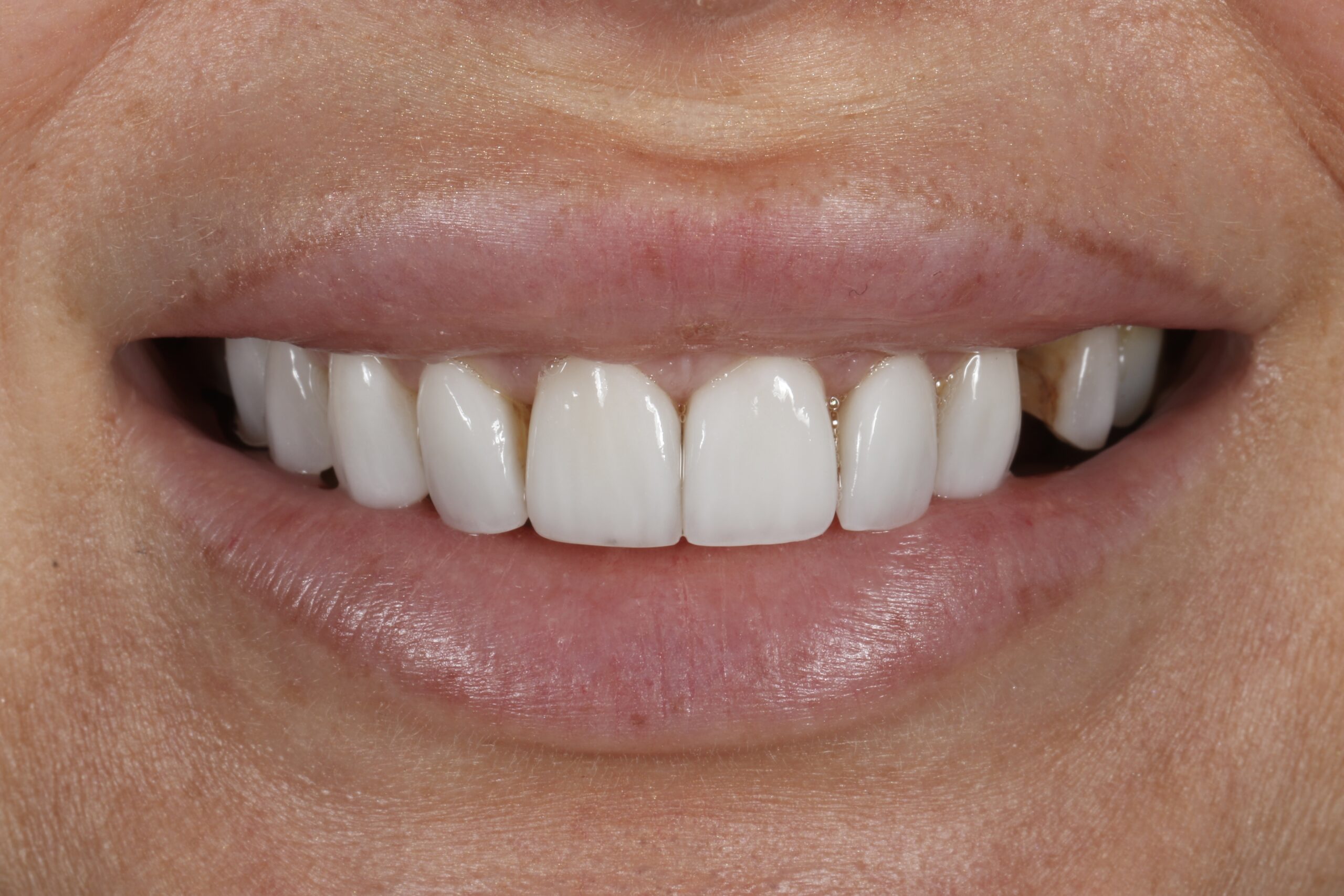 ringwaydental