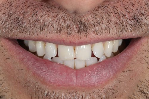 ringwaydental