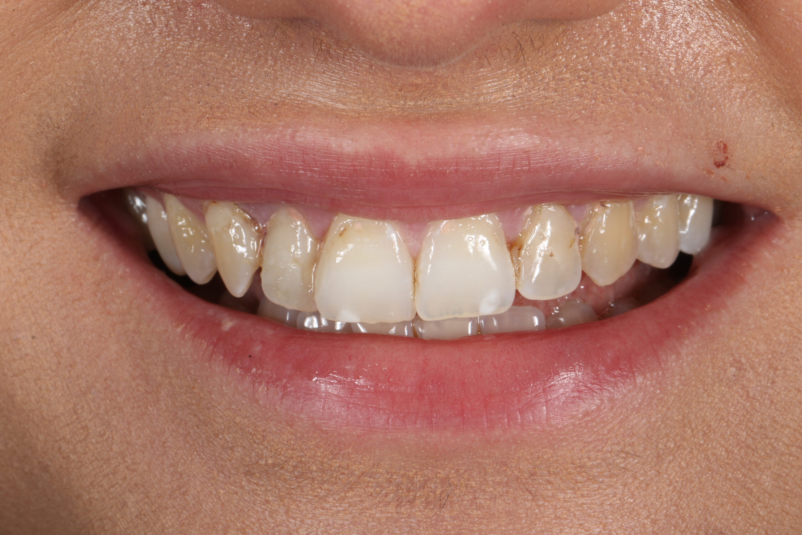 ringwaydental