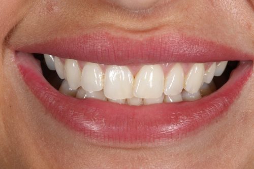ringwaydental