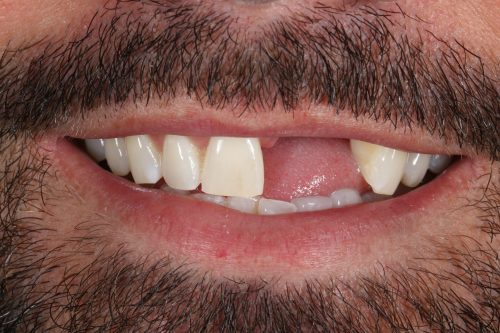 ringwaydental