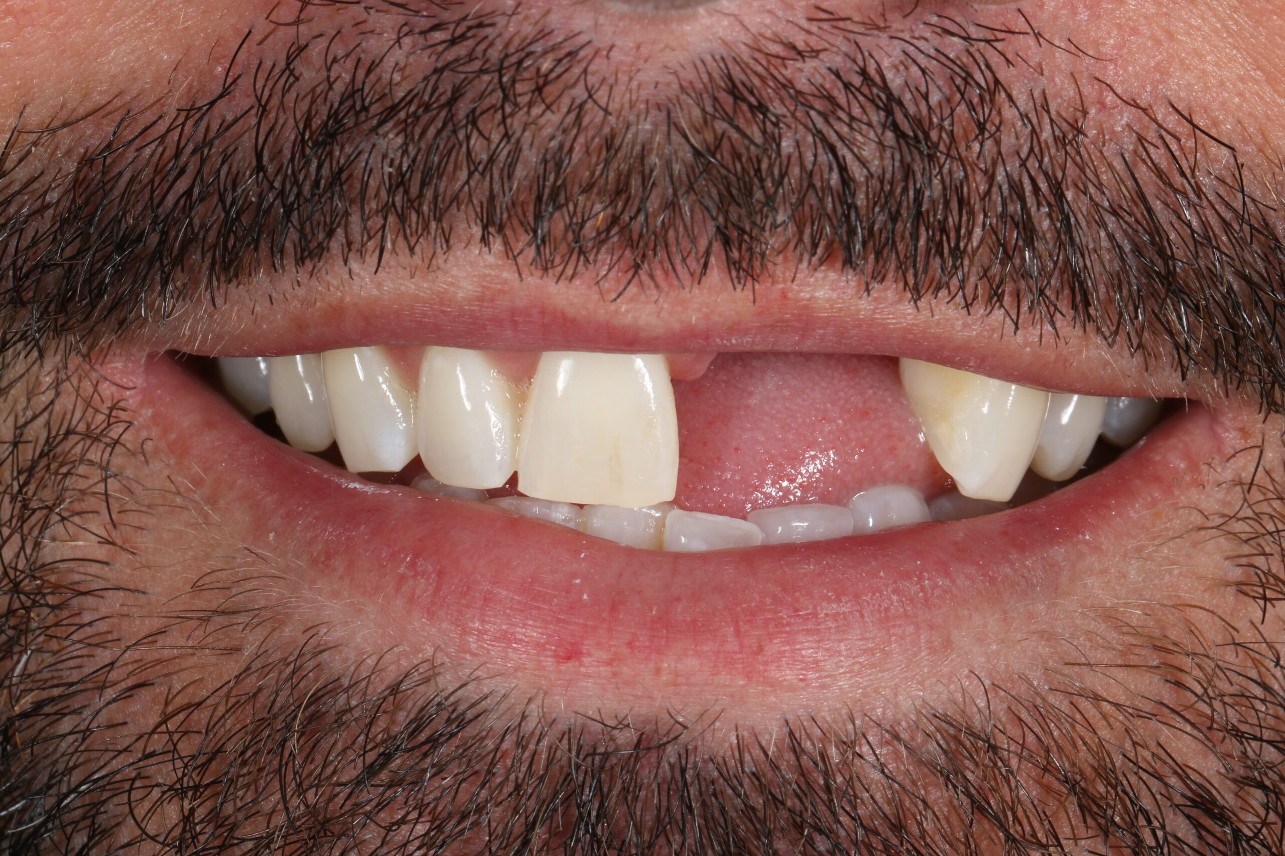 ringwaydental